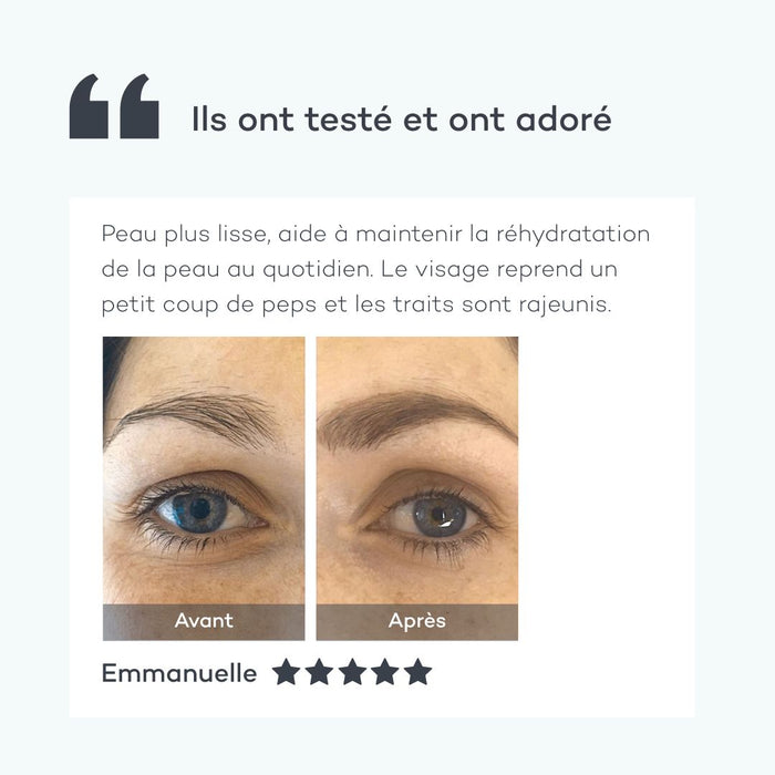 Hialurónico Absoluto