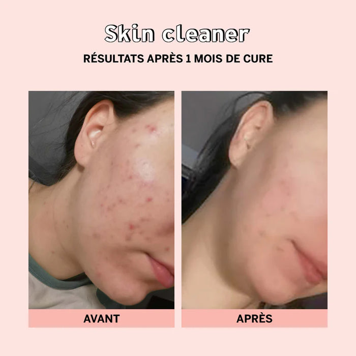 Limpiador de piel - Liquidación parada Ref