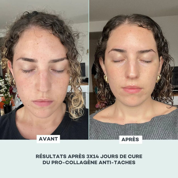 Solución Anti-Manchas