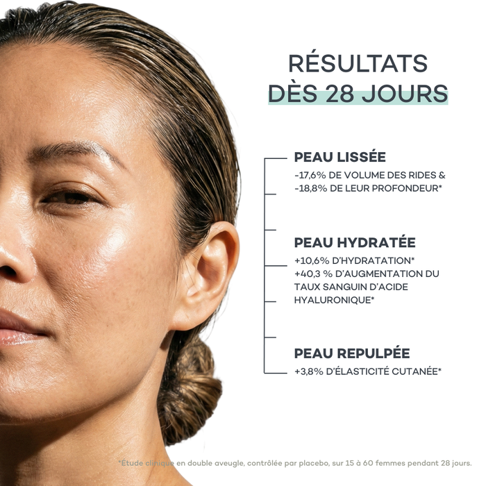 Inyecciones de Ácido Hialurónico