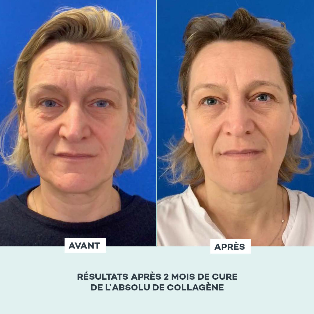 complément collagène