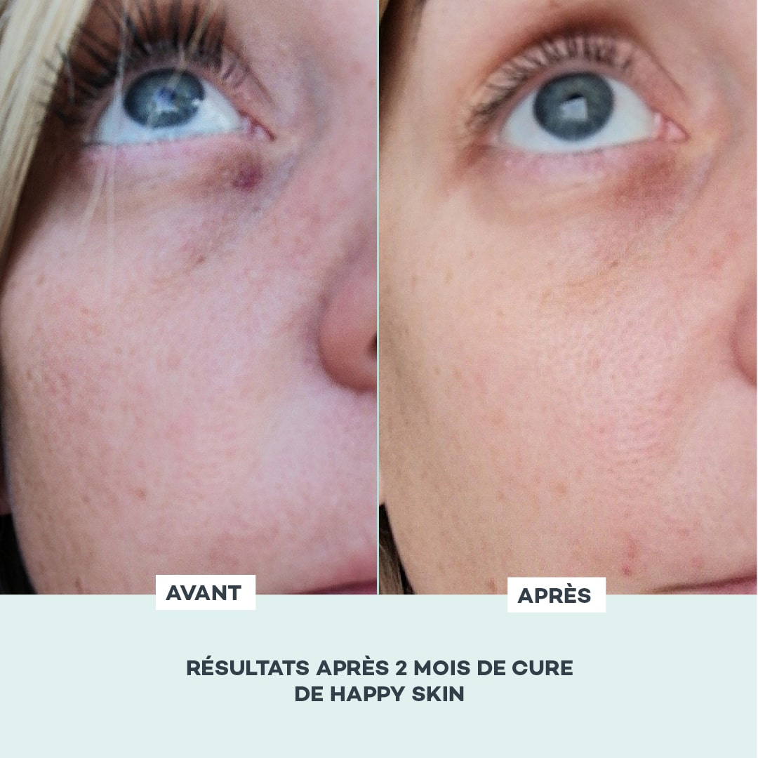 Gomitas BELLE PEAU