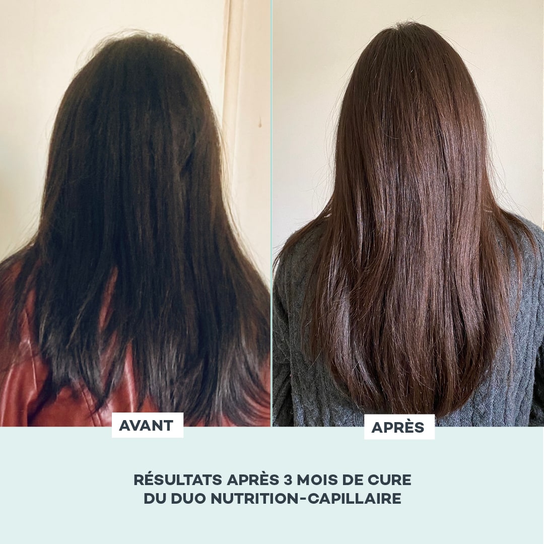 Dúo de Nutrición Capilar
