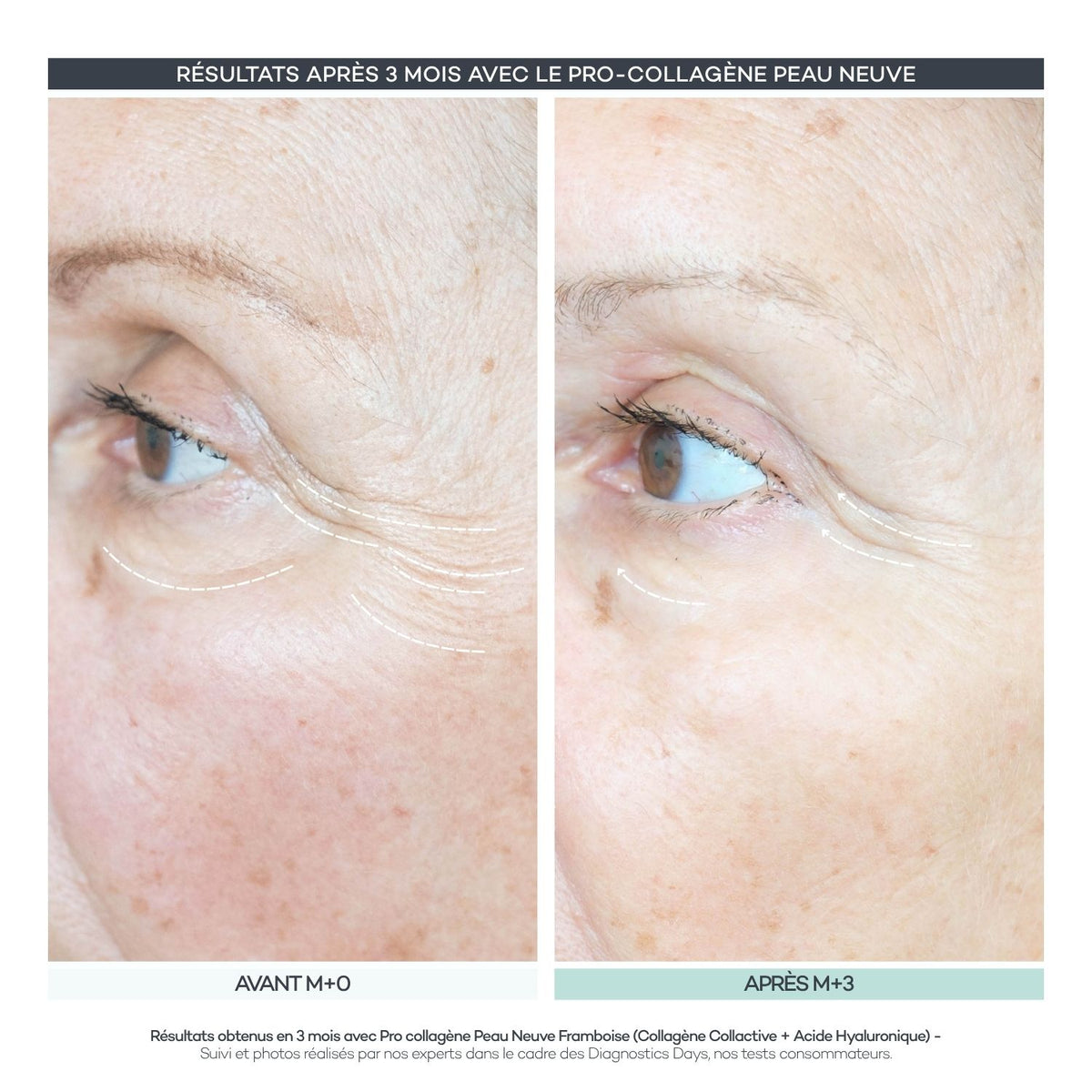 Pro-Collagen Nueva Piel 28 Bastones