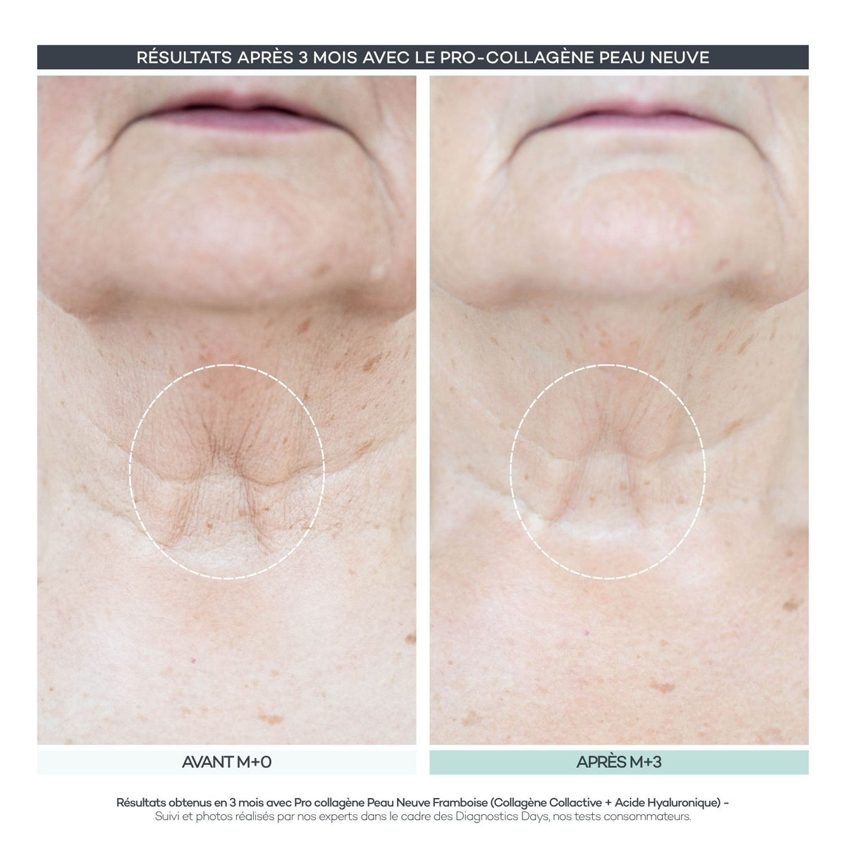 Pro-Collagen Nueva Piel 28 Bastones