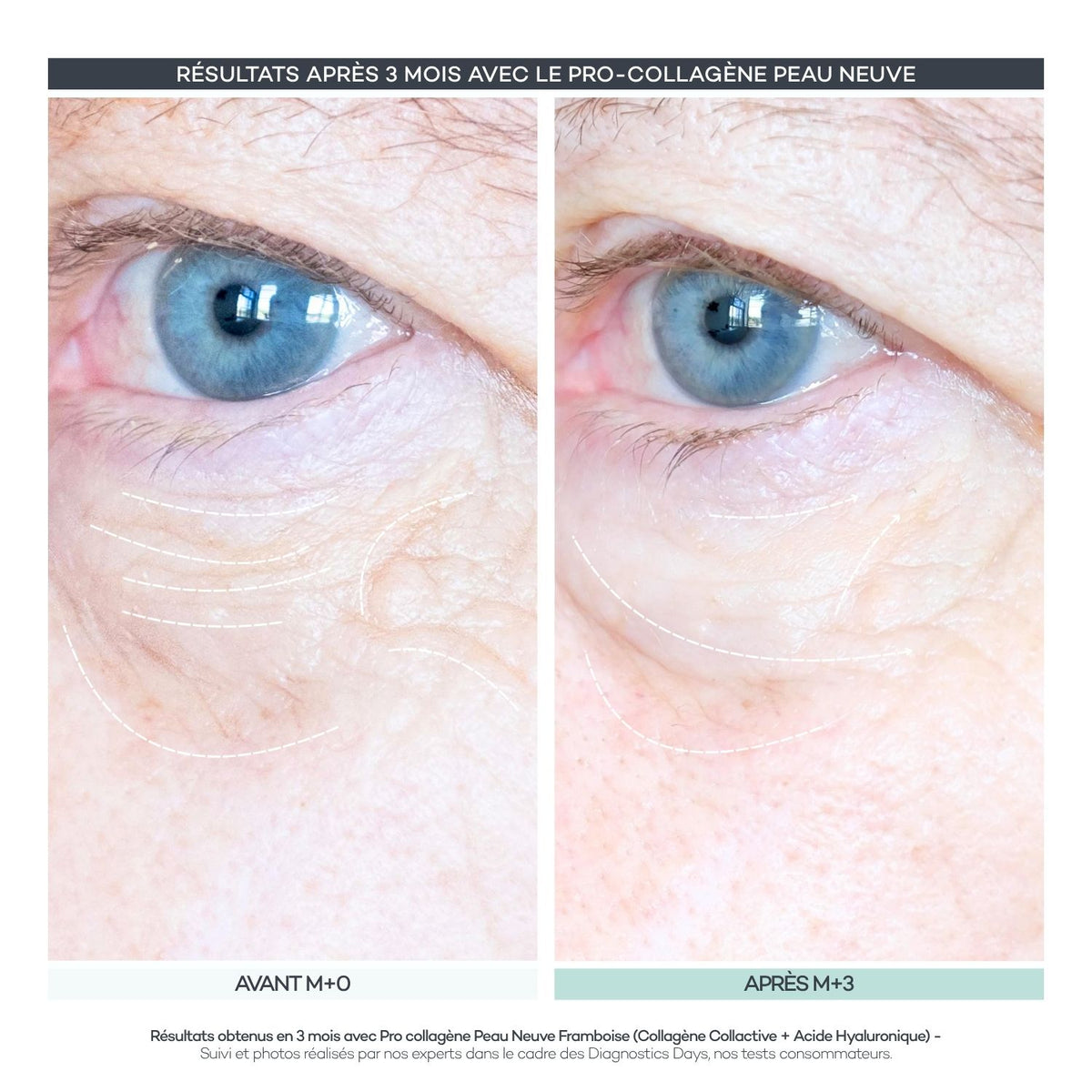 Pro-Collagen Nueva Piel 28 Bastones