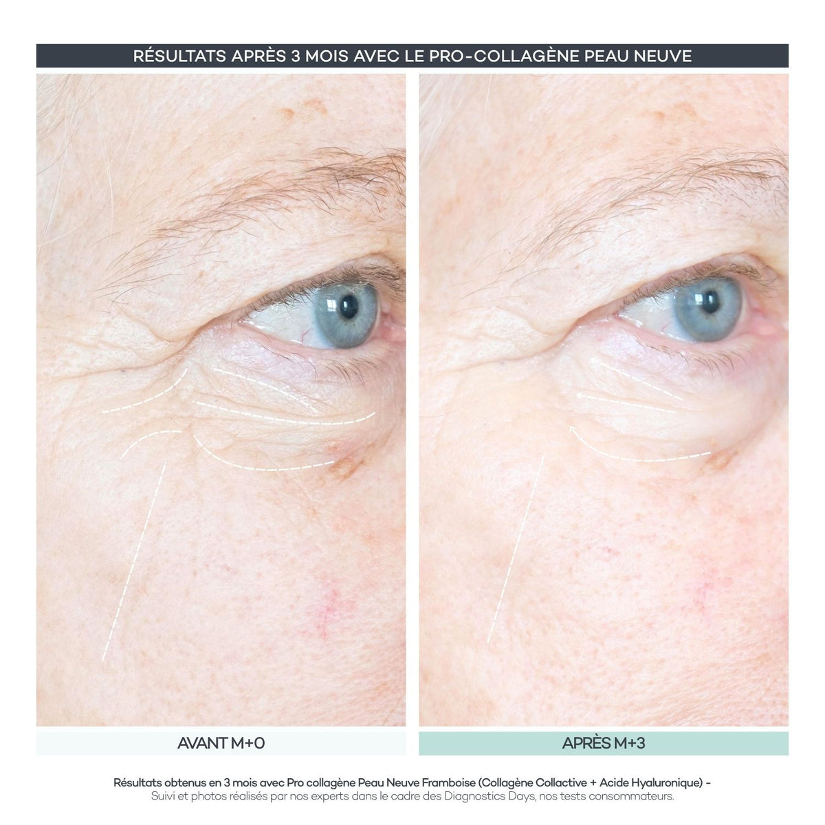Pro-Collagen Nueva Piel 28 Bastones