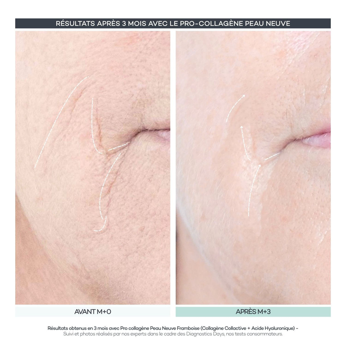 Pro-Collagen Nueva Piel 28 Bastones