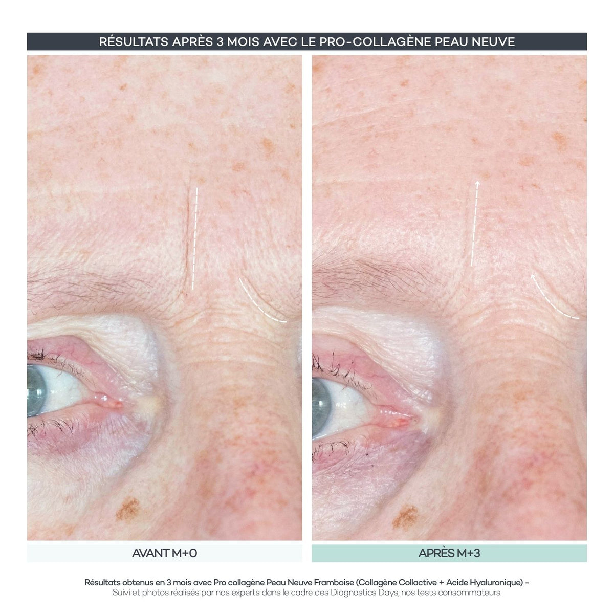 Pro-Collagen Nueva Piel 28 Bastones
