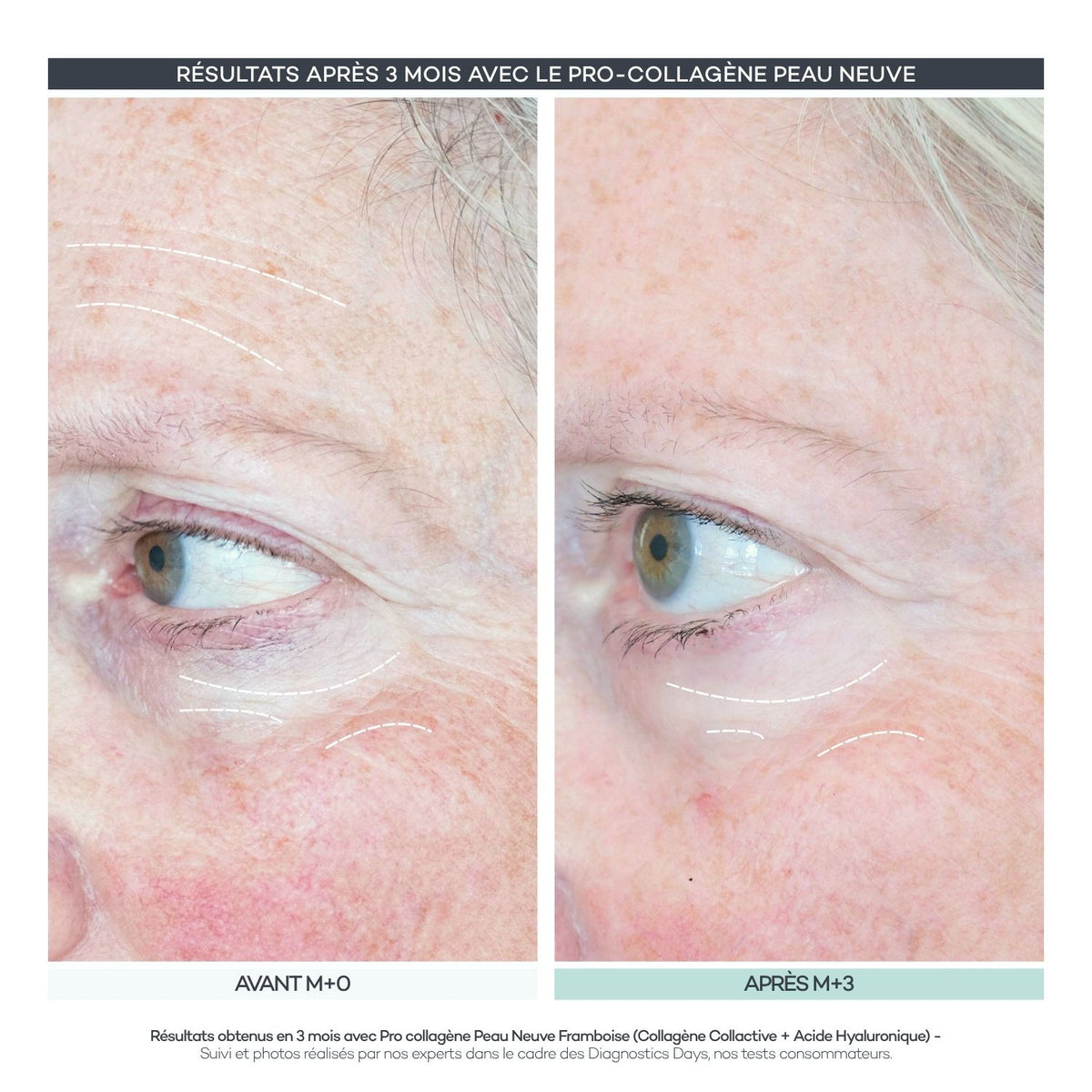 Pro-Collagen Nueva Piel 28 Bastones