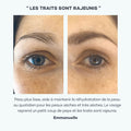 acide hyaluronique