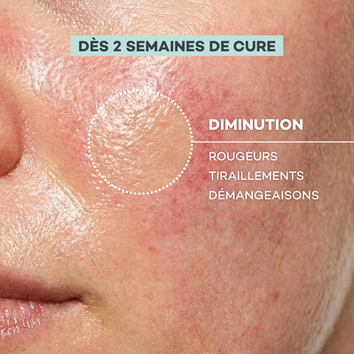 Rutina Piel Sensible