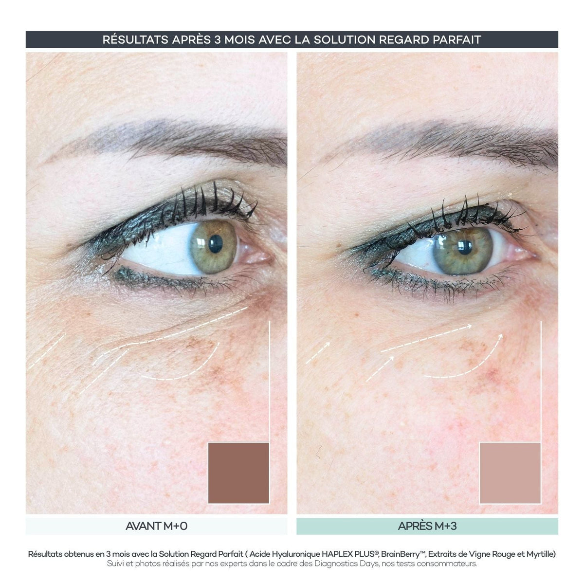 Avant après 3 mois du Shot Regard Parfait de la Routine Découverte Peau en sticks : contour des yeux lissé et cerne éclairci à M+3