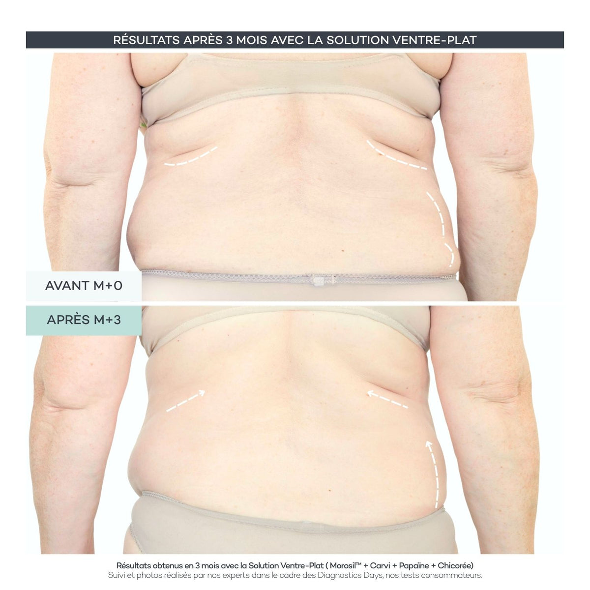 Solución para vientre plano - Body-Reset