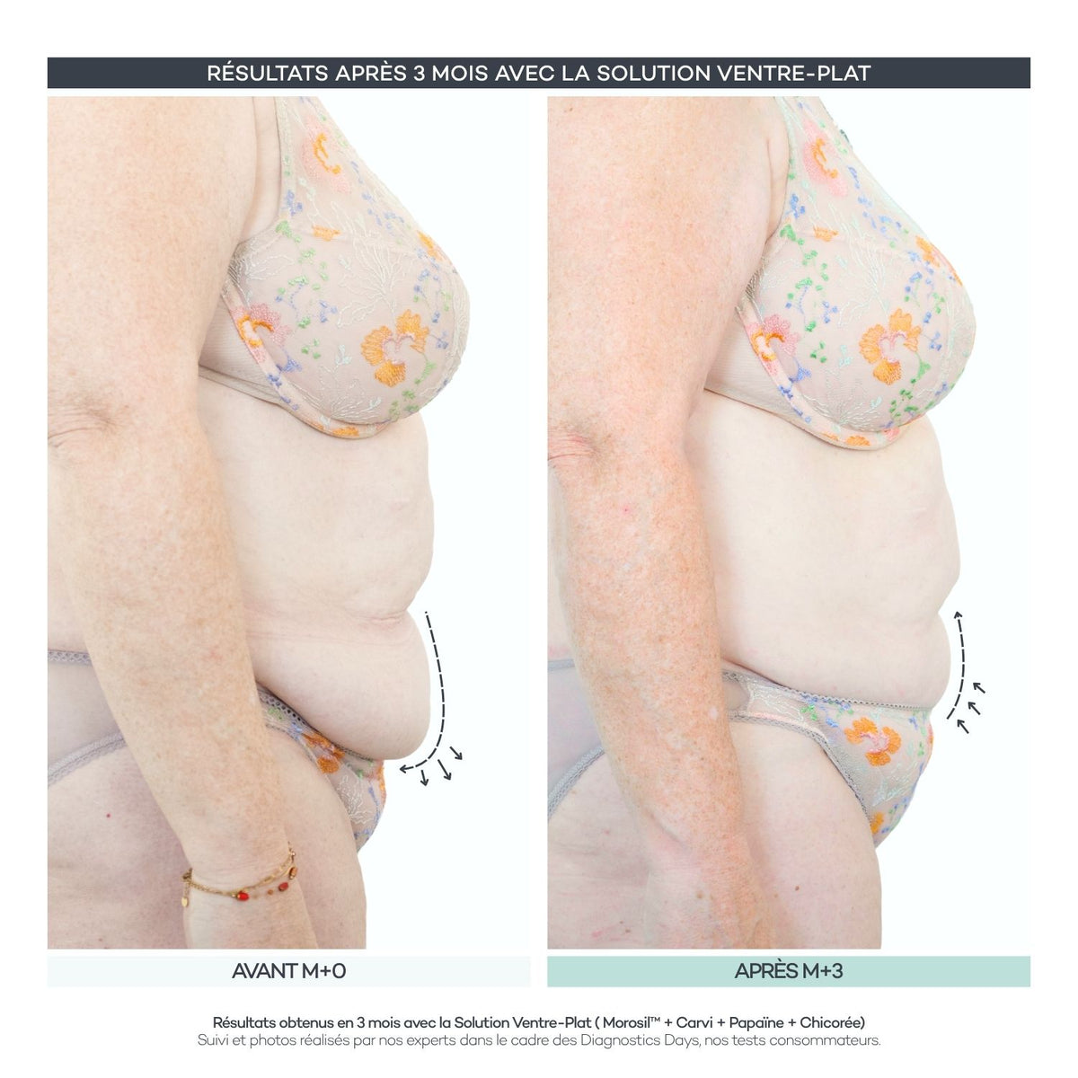 Solución para vientre plano - Body-Reset