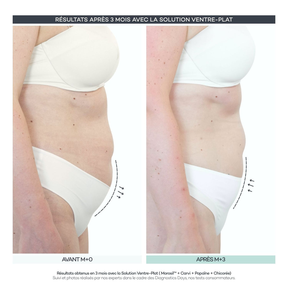 Solución para vientre plano - Body-Reset