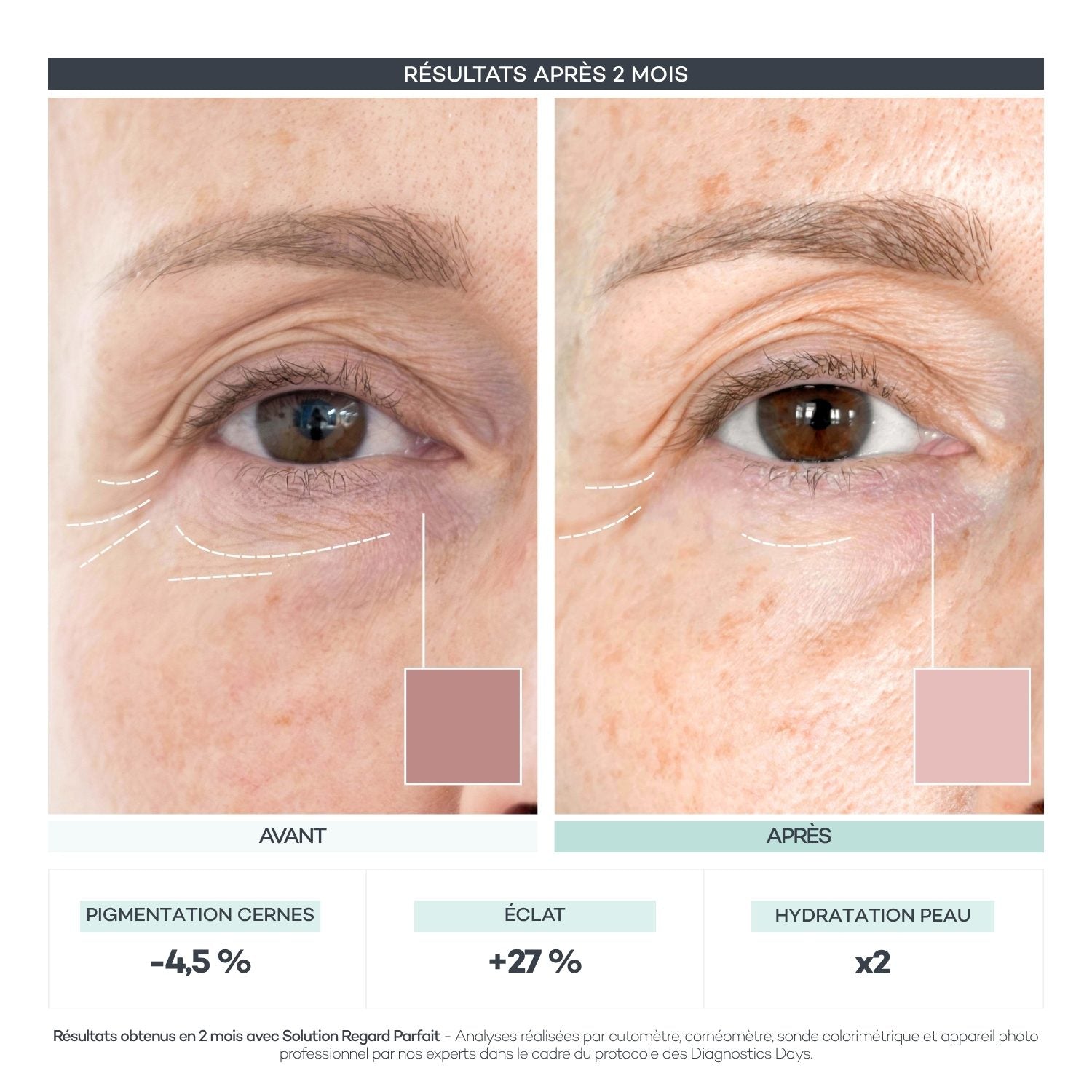 Avant/après Diagnostics Days — Regard Parfait